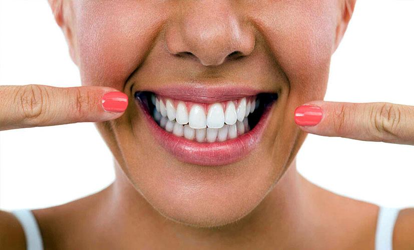 Diş Beyazlatma Yöntemleri Nelerdir? Diş Beyazlatma Nasıl Yapılır?