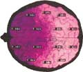 Beyin Haritalaması - Kantitatif EEG/ QEEG 13