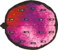 Beyin Haritalaması - Kantitatif EEG/ QEEG 23
