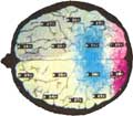 Beyin Haritalaması - Kantitatif EEG/ QEEG 27