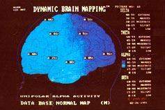 Beyin Haritalaması - Kantitatif EEG/ QEEG 5