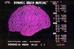 Beyin Haritalaması - Kantitatif EEG/ QEEG 43