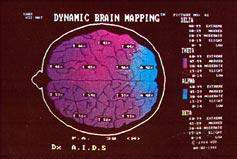 Beyin Haritalaması - Kantitatif EEG/ QEEG 45