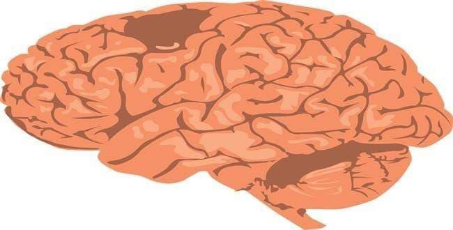 Beyin ile bilgisayar arasındaki en önemli fark