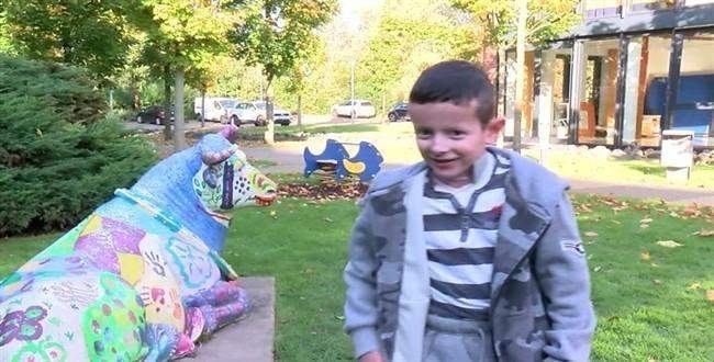 'Kelebek çocuk' gen tedavisiyle iyileşti