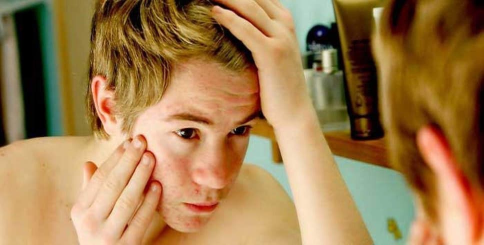 Ergenlerde davranış değişikliklerine dikkat!