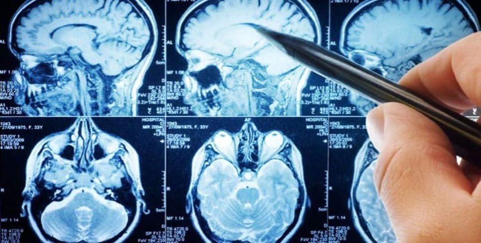 ALS'nin ilk evreleri