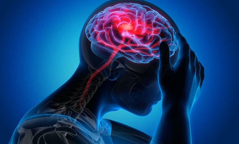 Beyne Pıhtı Atması Nedir? Tedavi Süreci