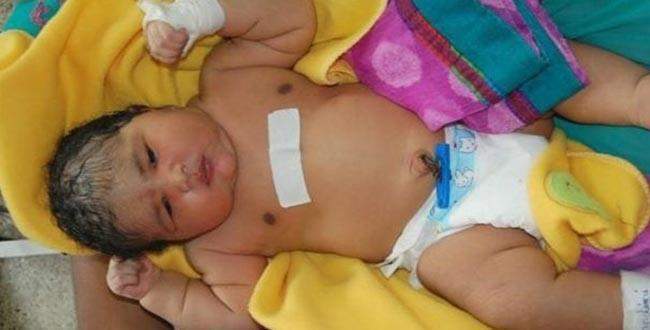 Hindistan'da 6,8 kiloluk bebek dünyaya geldi