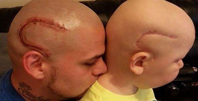 Oğlunun yara izi şeklinde dövme yaptırdı