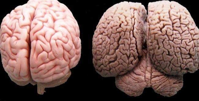 Gerçek bir insan beynini incelemek ister miydiniz