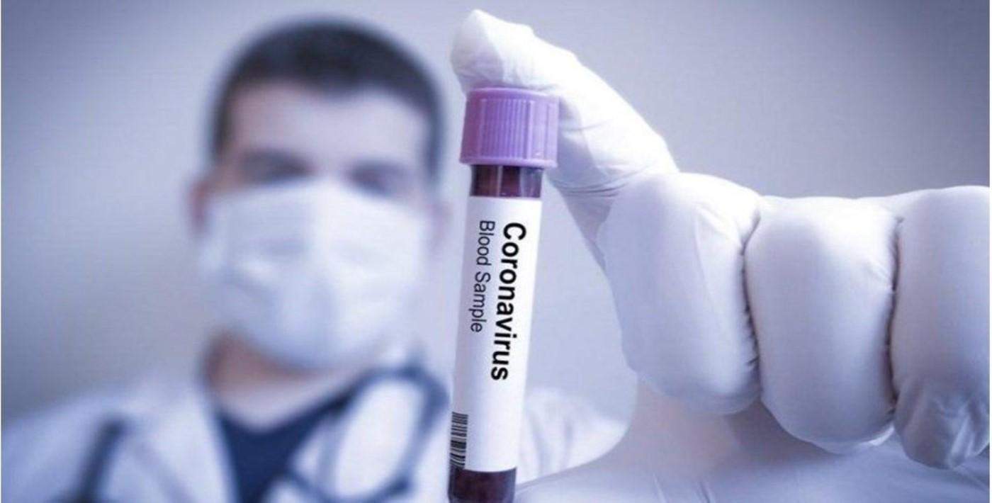 Çin'den Korona (Corona) Virüsü Açıklaması