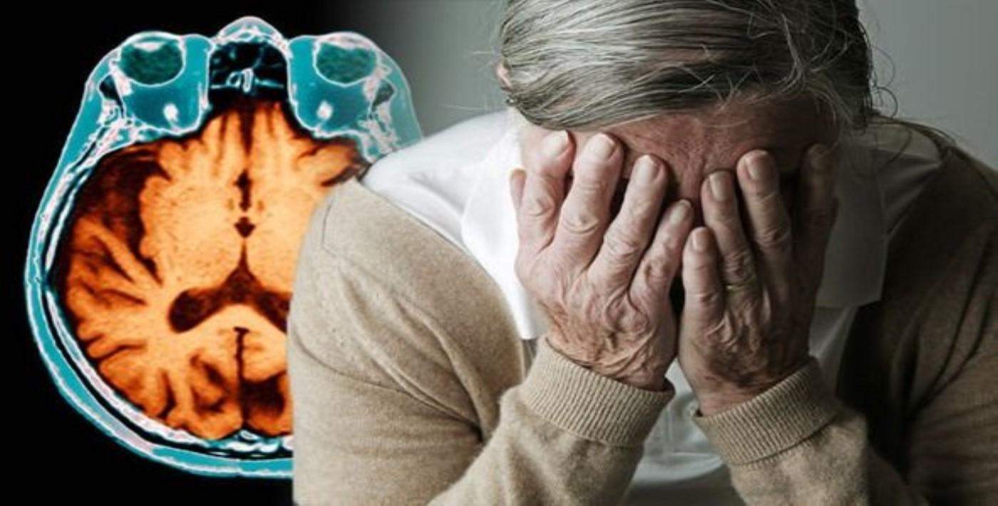 Alzheimer artık tarihe karışacak! | e-Psikiyatri