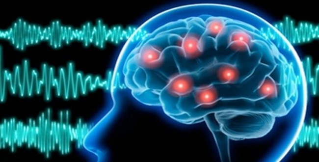 Sürekli epilepsi nöbeti, beynin yapısını bozabilir