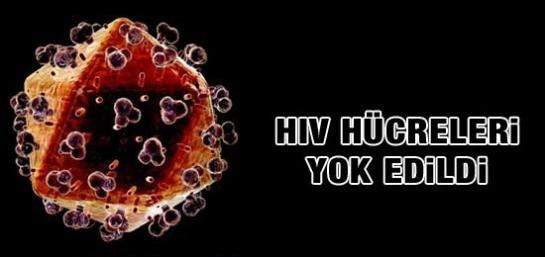 HIV HÜCRELERİ YOK EDİLDİ