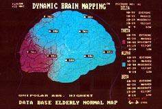 Beyin Haritalaması - Kantitatif EEG/ QEEG 6