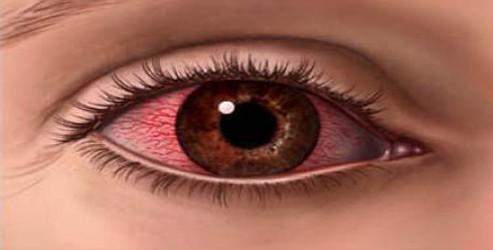 Gözü şiddetle kaşıma hastalık belirtisi