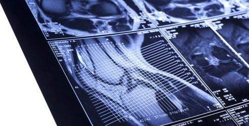 Gereksiz röntgen kanser vakalarını artırıyor