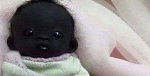 Dünyanın en 'siyah' bebeği